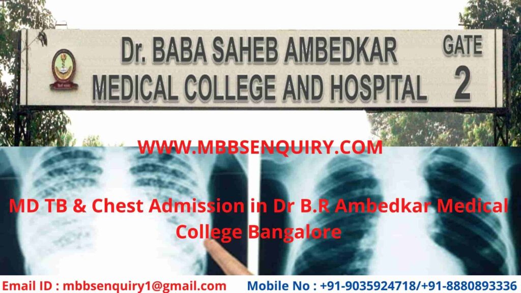 MD TB & Chest admission in ambedkar medical college bangalore