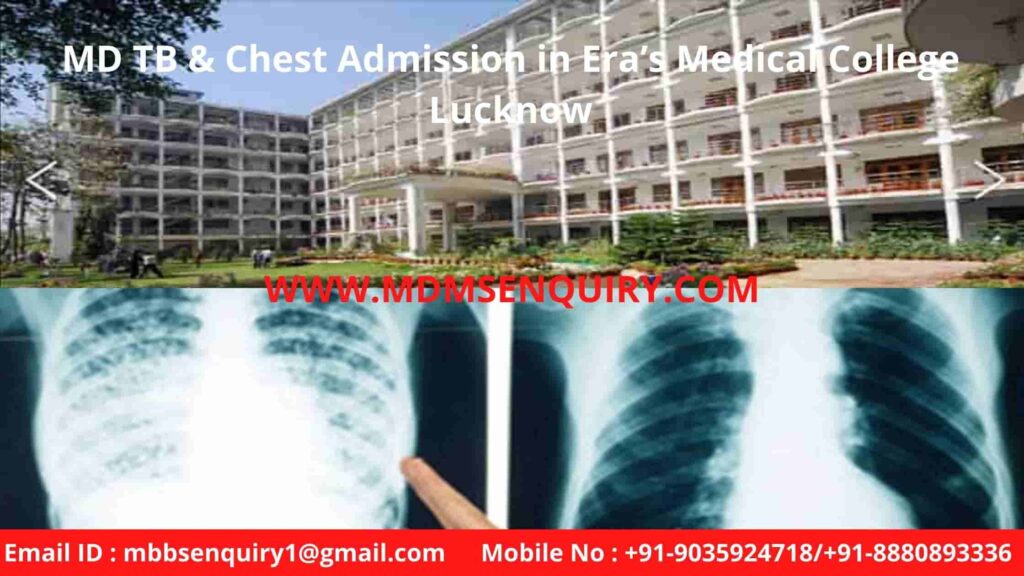 MD TB & Chest Admission in Era’s Medical College Lucknow