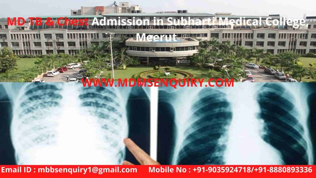 MD TB & Chest Admission in Subharti Medical College, Meerut.jpg