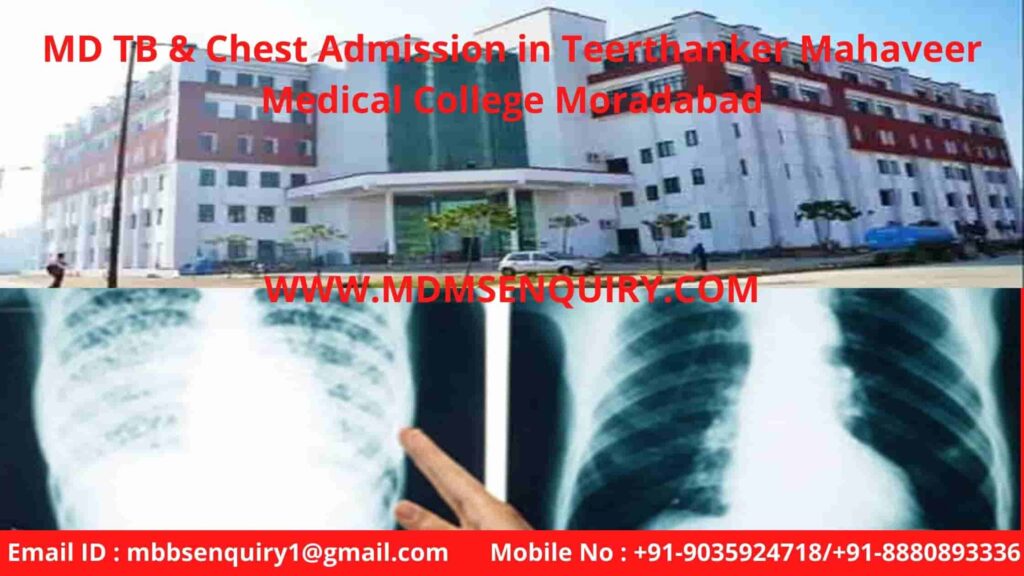 MD TB & Chest Admission in Teerthanker Mahaveer Medical College Moradabad