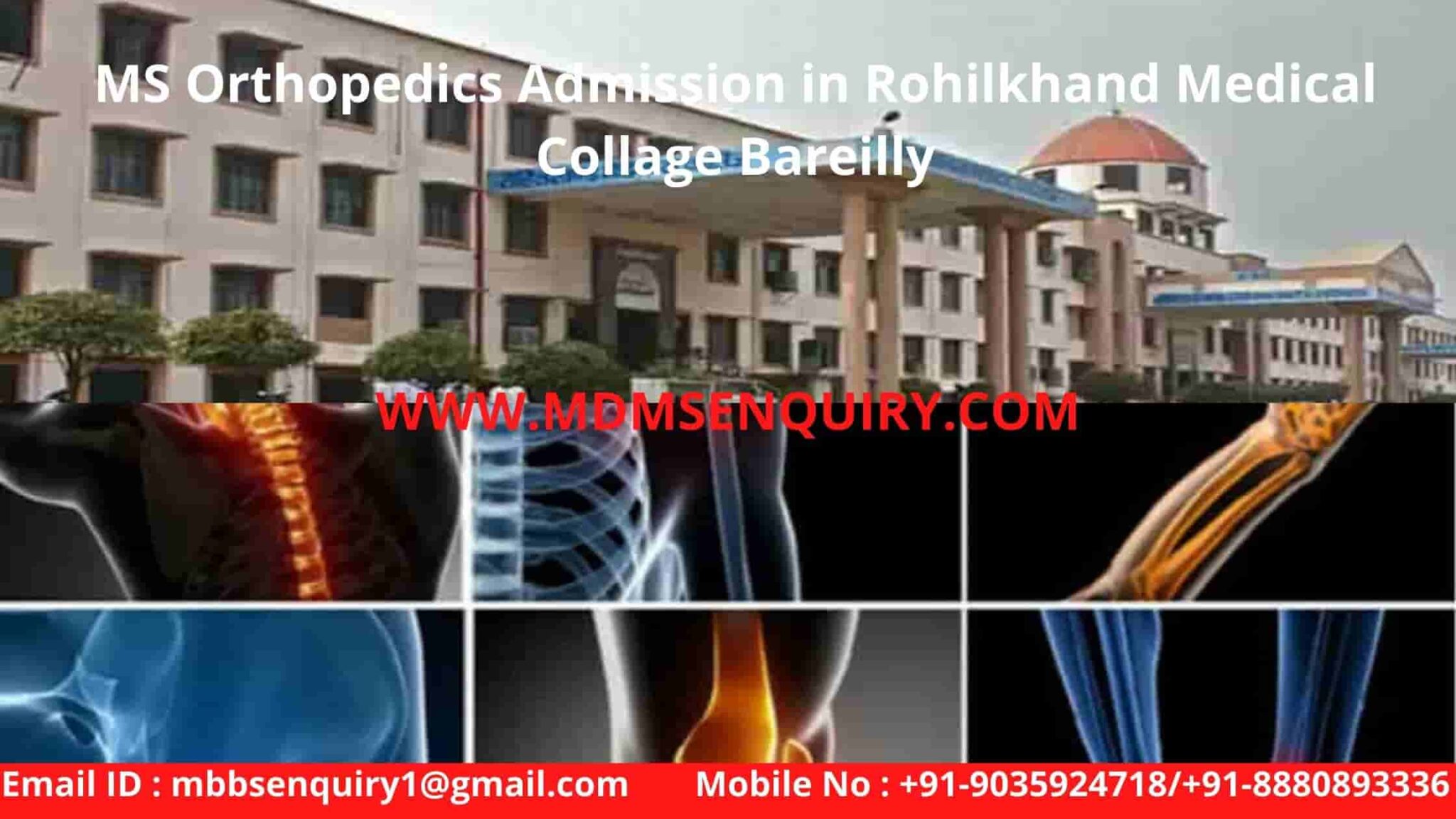 MS Orthopaedics Admission in Rohilkhand Medical College Bareilly